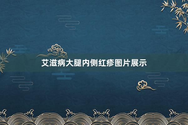 艾滋病大腿内侧红疹图片展示